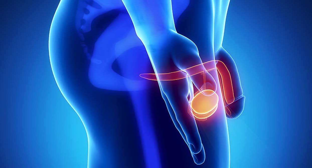 ορχεοεπιδιδυμιτιδα