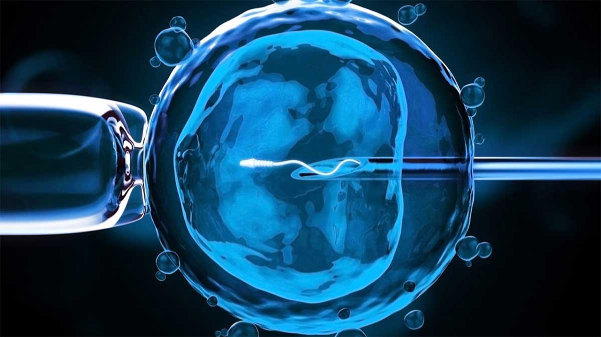 ivf