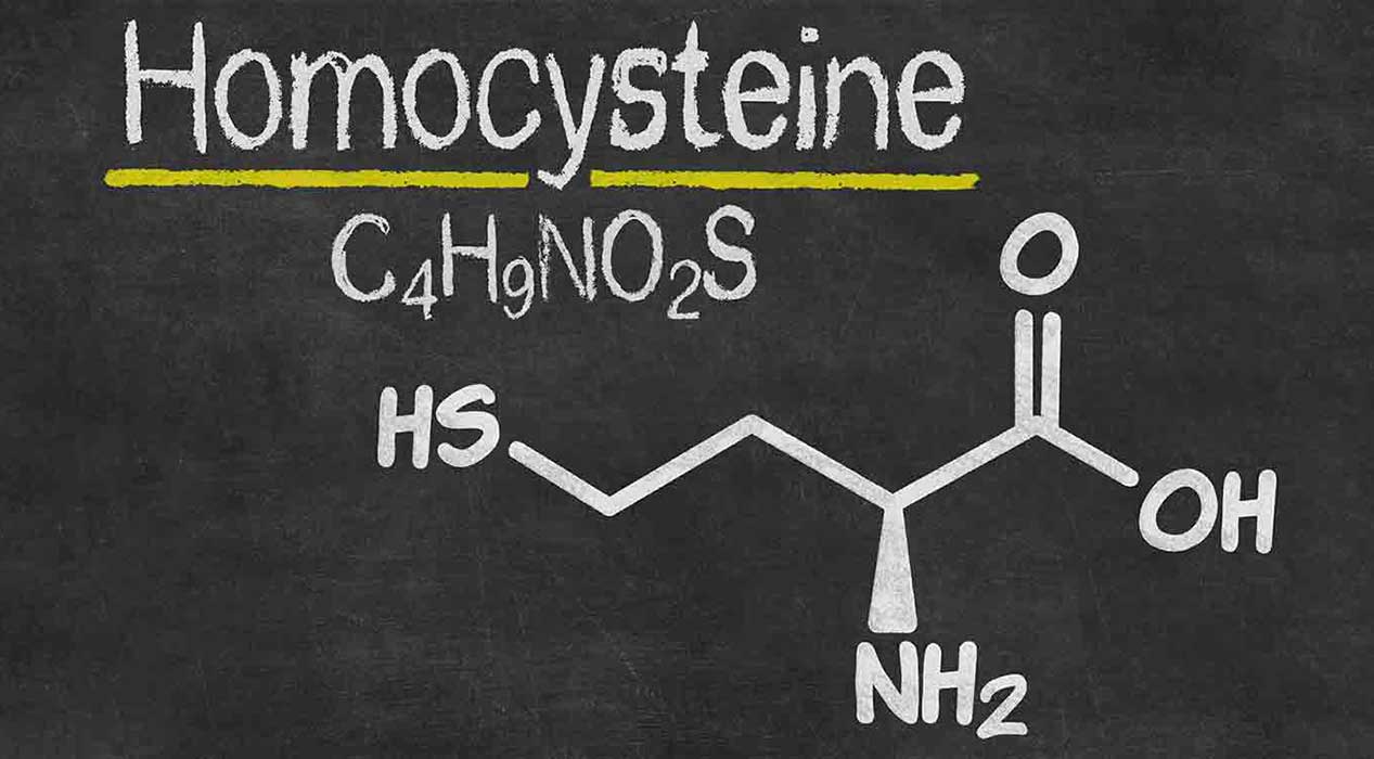 ομοκυστεΐνη και στυτική δυσλειτουργία